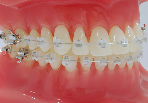 マルチブラケット装置