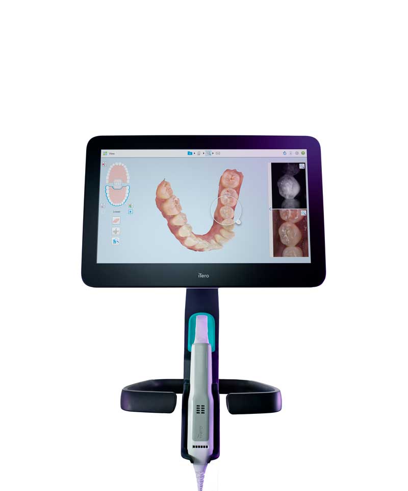 マウスピース型矯正装置