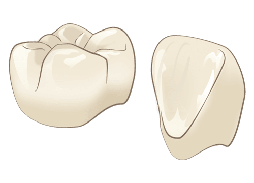 ジルコニアクラウン